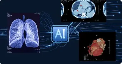 AI in Medical Imaging: How Deep Learning Is Transforming Diagnosis